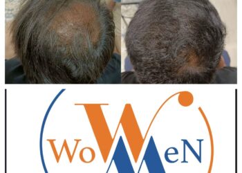 “WowMen Clinic: 10+ Years & 4500+ Satisfied Clients, A Leader in Sustainable Cosmetic Treatments!”