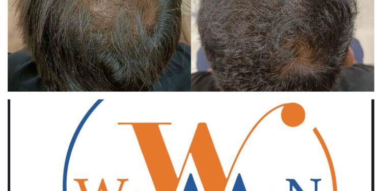 “WowMen Clinic: 10+ Years & 4500+ Satisfied Clients, A Leader in Sustainable Cosmetic Treatments!”