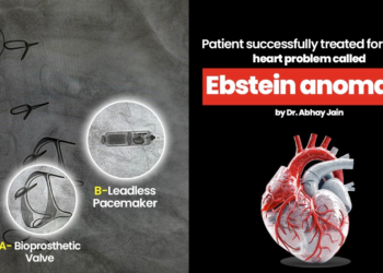 Patient successfully treated for a rare heart problem called Ebstein anomaly by Dr. Abhay Jain