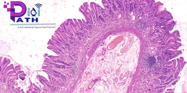 DigiPath: Pioneering the Digital Revolution in Diagnostic Pathology