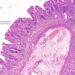 DigiPath: Pioneering the Digital Revolution in Diagnostic Pathology