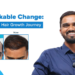 Unlock Your Confidence with VCare’s Revolutionary Hair Regrowth Solution!