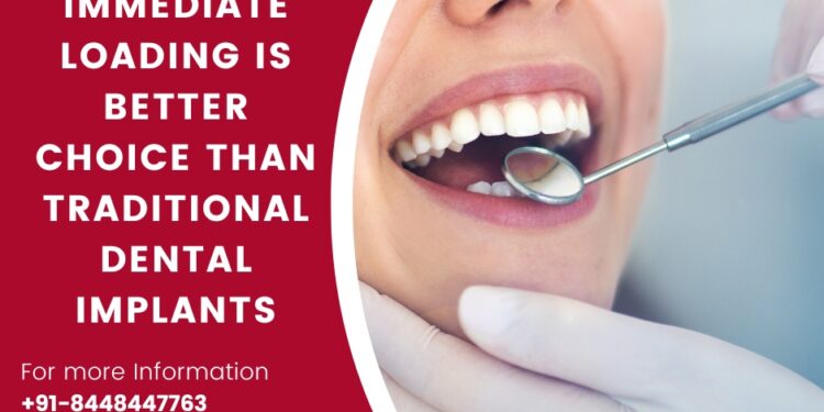 Ten reasons why Corticobasal Immediate Loading Implants outshine traditional dental implants, redefining success in dental restoration