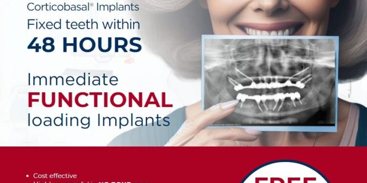 Discover the Power of Simpladent: A Network of Clinics Bringing World Class Dental Implant Within Reach