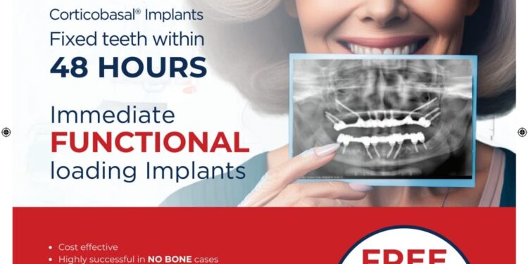 Simpladent Sparks Nationwide Smiles: Immediate Loading Dental Implants to Soon Reach Every City!