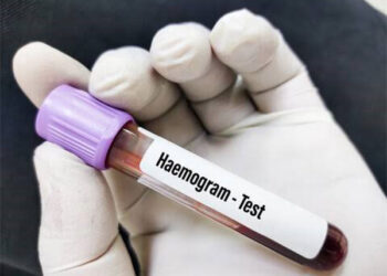 Why is a Hemogram Test Prescribed?