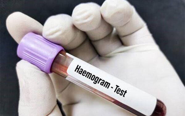 Why is a Hemogram Test Prescribed?