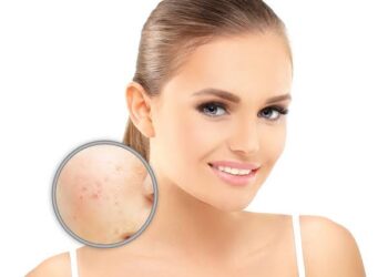 How to Reduce Skin Pigmentation?
