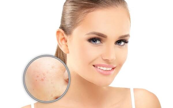 How to Reduce Skin Pigmentation?