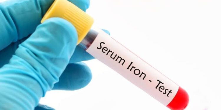5 Signs You Need to Get an Iron Test Done