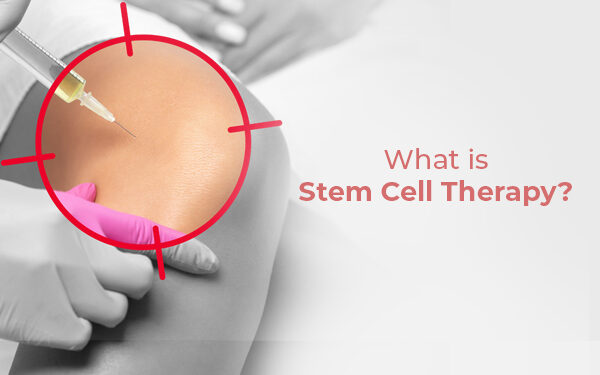 What Is Stem Cell Therapy? How Does It Work?
