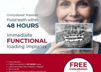 48 Hours Immediate Loading Dental Implants: A Revolutionary Solution for Older Patients