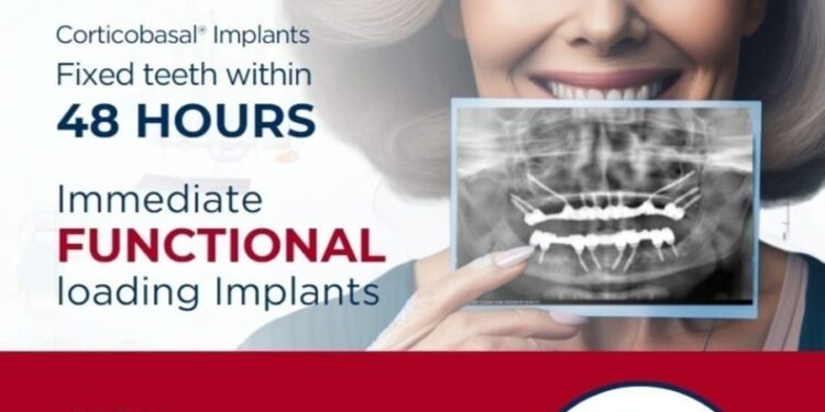 48 Hours Immediate Loading Dental Implants: A Revolutionary Solution for Older Patients